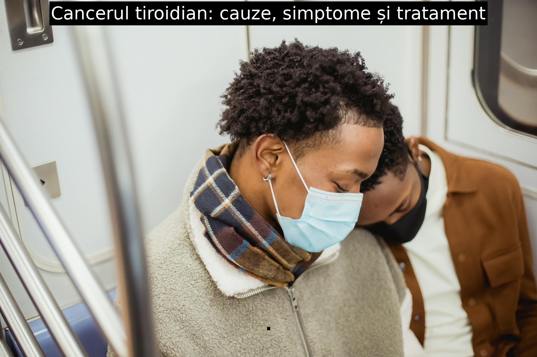 Cancerul tiroidian: cauze, simptome și tratament